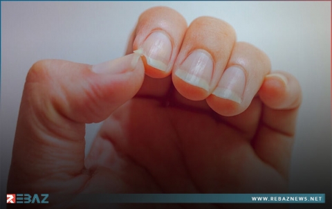 5 أعراض بأظافرك قد تكشف إذا كنت مصابا بفيروس كورونا