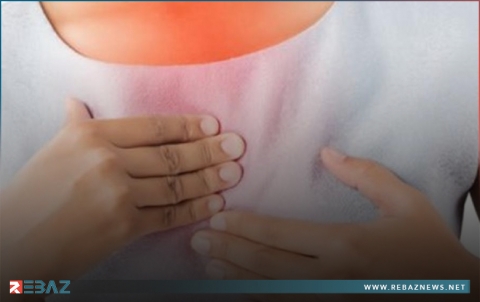 حرقة المعدة