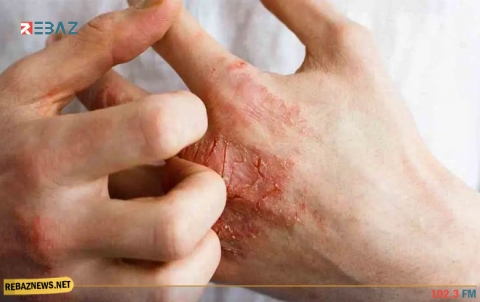 كيف يمكننا وقاية الجلد من الأمراض في زمن كورونا؟