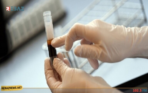 بريطانيا تبدأ تجارب لفحص إمكانية علاج كورونا بمساعدة بلازما الدم