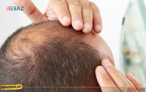 فواكه وخضار تحارب تساقط الشعر