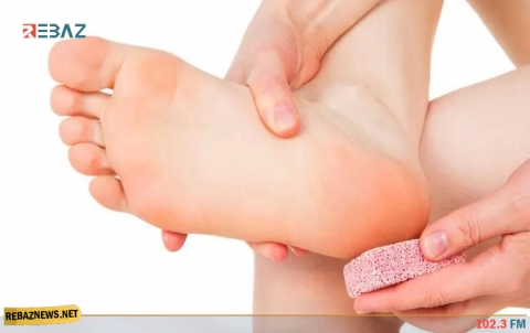 وصفات طبيعية لمعالجة تشقق القدمين