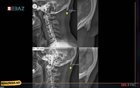 بسبب الهواتف.. دراسة تحذر من 