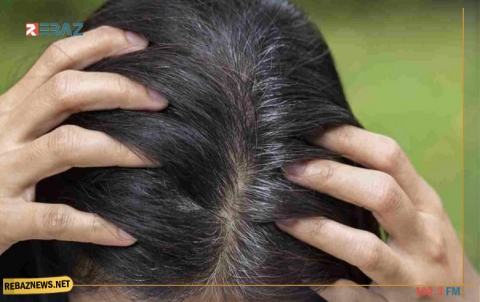 وصفات طبيعية ومنزلية لعلاج ظهور شيب الشعر