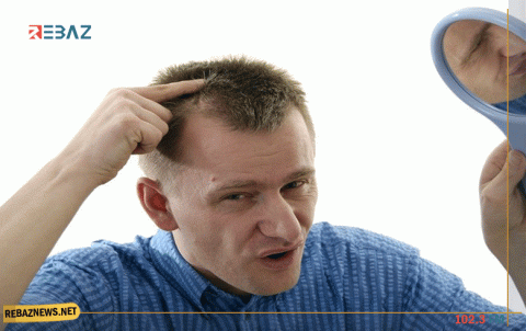 القهوة لمكافحة الصلع