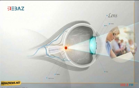  الاستحمام بالعدسات اللاصقة قد يتسبب بفقدان النظر