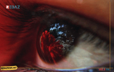 بكتيريا تستوطن مقلة العين قد تقضي على العمى