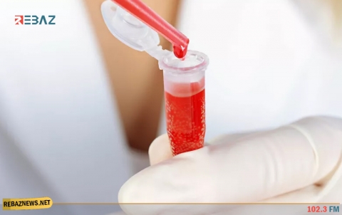 علماء يكشفون فصيلة الدم الأكثر خطورة