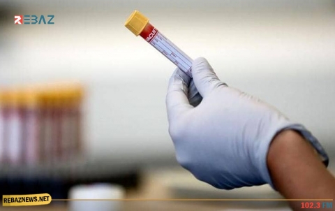 الرجال أم النساء؟ من الأكثر إنتاجا لأجسام مضادة لكورونا