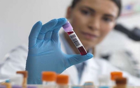 حمية غذائية لكل فصيلة دم من أجل جسم مثالي