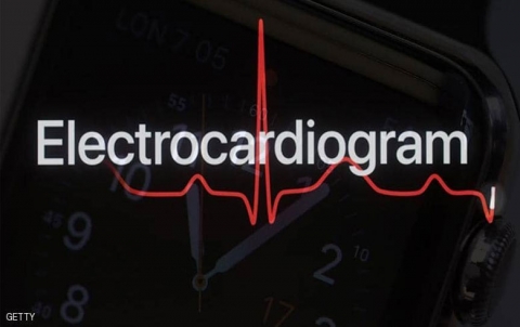 دراسة: ساعة أبل تسهم في رصد مشاكل خطيرة في القلب