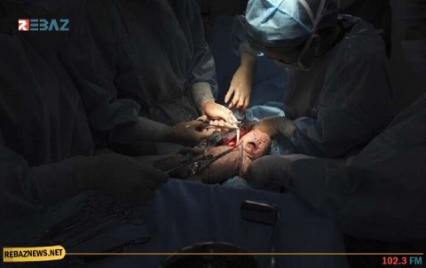 كيف تؤثر الولادة القيصرية على مناعة الأطفال؟