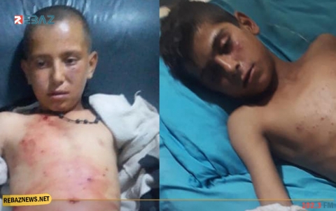 إصابة طفلين من مهجّري عفرين بانفجار في الشهباء