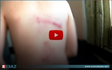 مسلحو PYD يستهدفون كوادر قناة كوردية في قامشلو